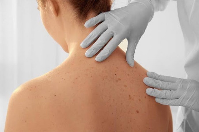 Dermatologia
